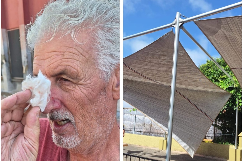 Cae parte  una pérgola colocada por Fomentas en el campo de petanca de San Jose de Las Longueras y hiere a uno de lo usuarios